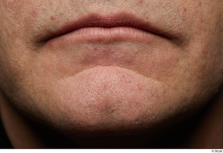  HD Face skin references Saahir Nasir lips mouth pores skin texture 0002.jpg